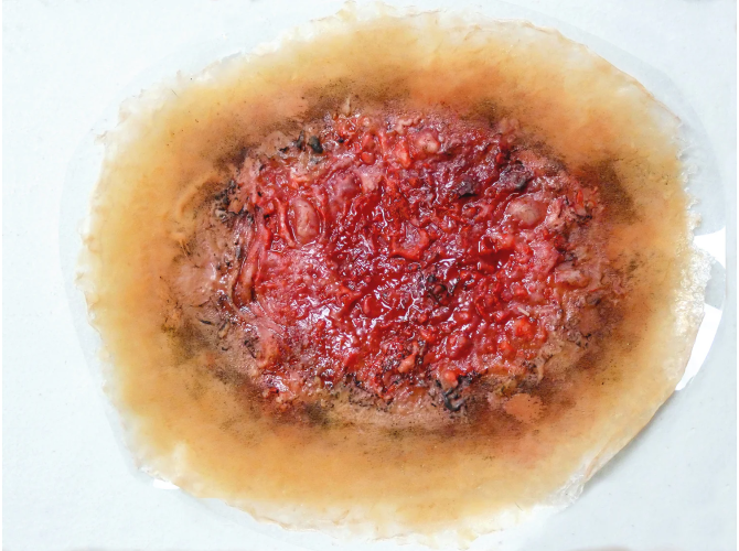 SW012_ThermalBurnLarge_MediumSkin_sm_1800x18004