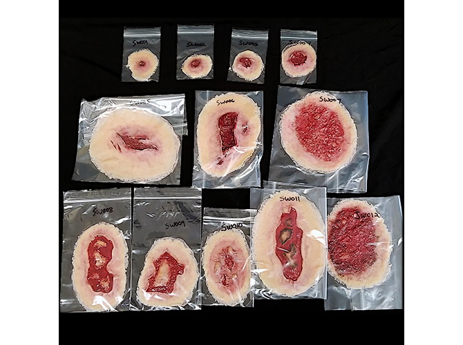 SW000-SelfAdhesiveWoundsKit_LT