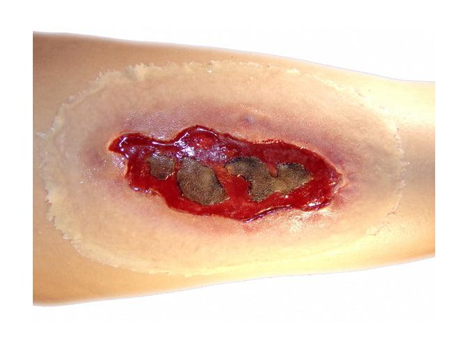 ElectricalBurnLARGE2_1800x18002