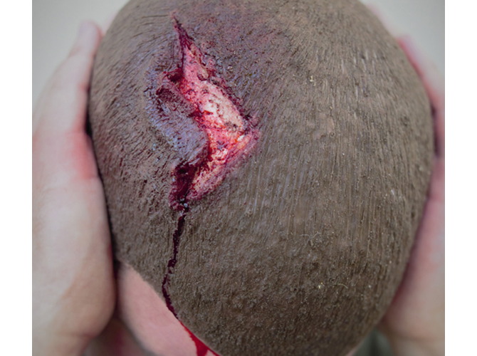 007_headWound_2