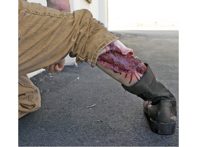 009calf_avulsion_light