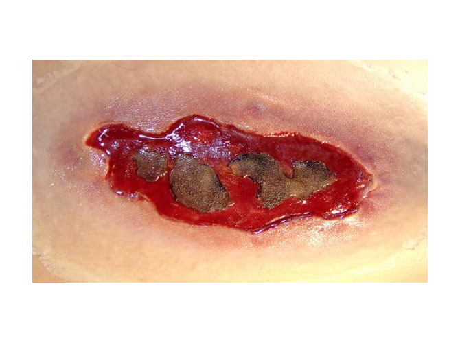 ElectricalBurnLARGE_1800x18001