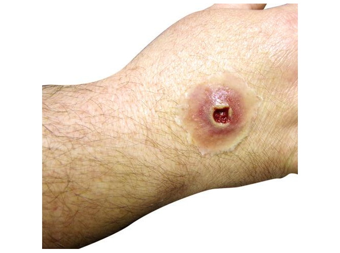 GSW-entry-small2_1800x18002