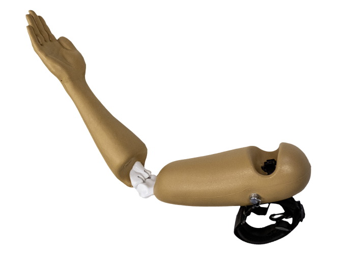 ElbowDislocation_Techline