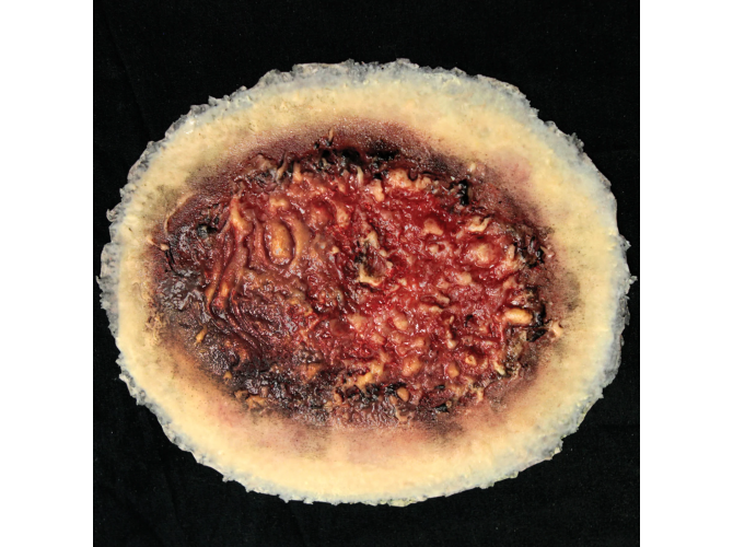 ThermalBurn_LARGE_SW012_a022ab75-2dad-489e-ab89-e7d81117f6a0_1800x18003