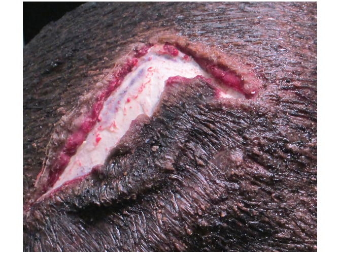 007_headWound_darktone_3