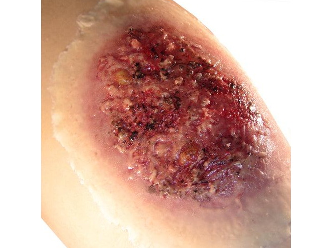 Thermal-Burn-Large_1800x1800