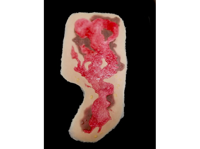 SW019_3degreeChest_debrided_1