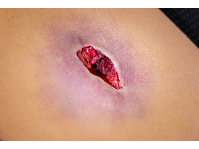 CTS-012Wound-Tunnel_Close1_1800x1800