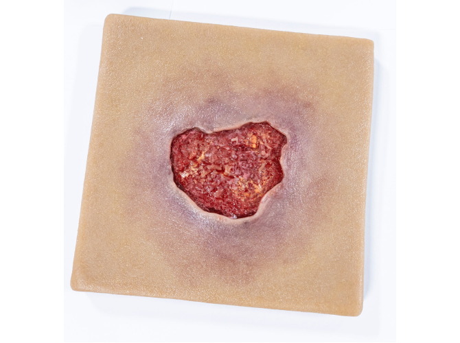 ST-3_Pressure-Injury-MAT_LIGHT_1800x1800 (1)