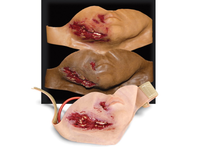 006_JawLaceration_3Tones