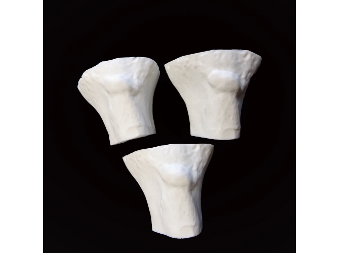 PTT-B51B B51-IO_kneeCAP_replacement