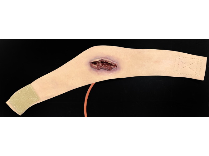 014_Neck_Laceration_front_Light