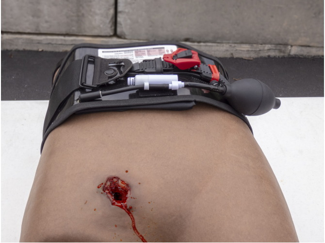 P1010792_Ab_AAJT-S_bleeding