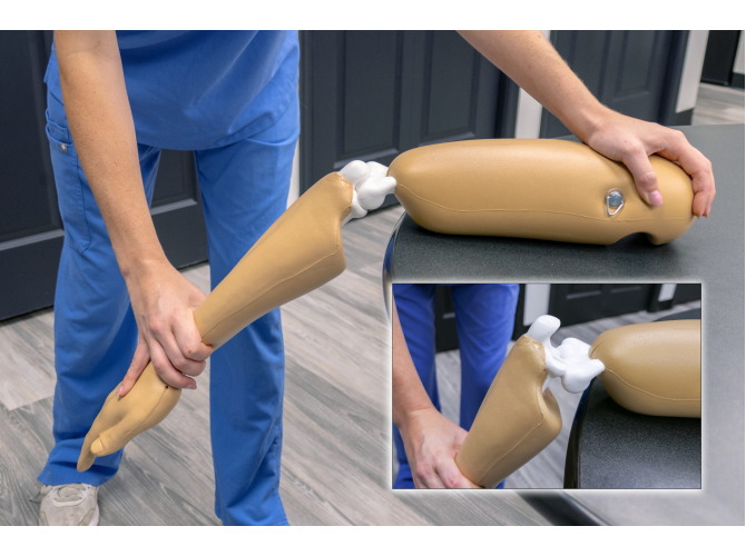 ElbowDislocation_Techline1