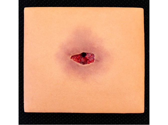 CTS-012Wound-Tunnel_Medium_88d5b4bc-0c76-4bab-8e8e-23c9eafa3d5a_1800x1800