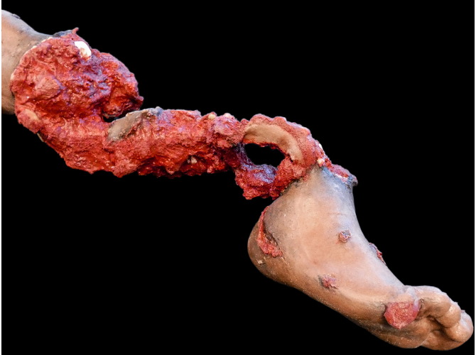 906_PT-Leg_Left_DarkSkinTone2