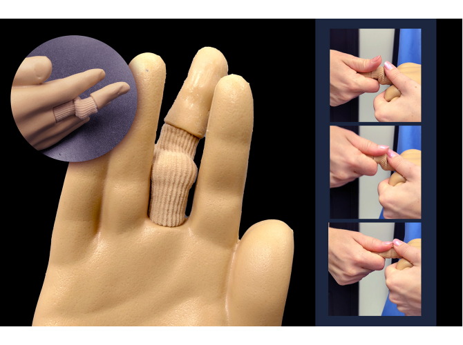 FingerDislocateTechline3