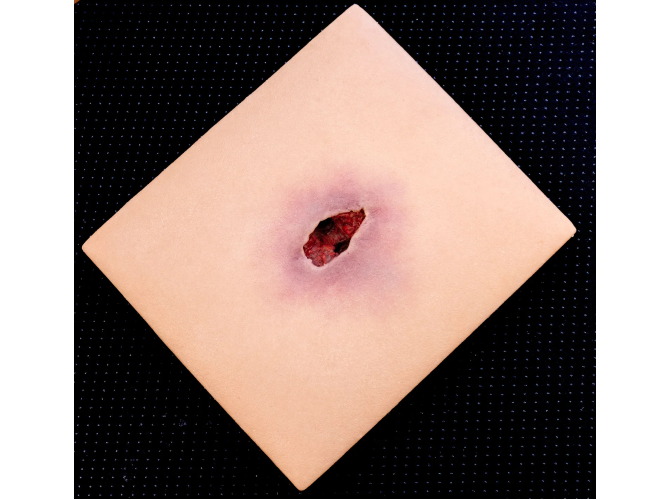 CTS-012Wound-Tunnel_LIGHT_1800x1800