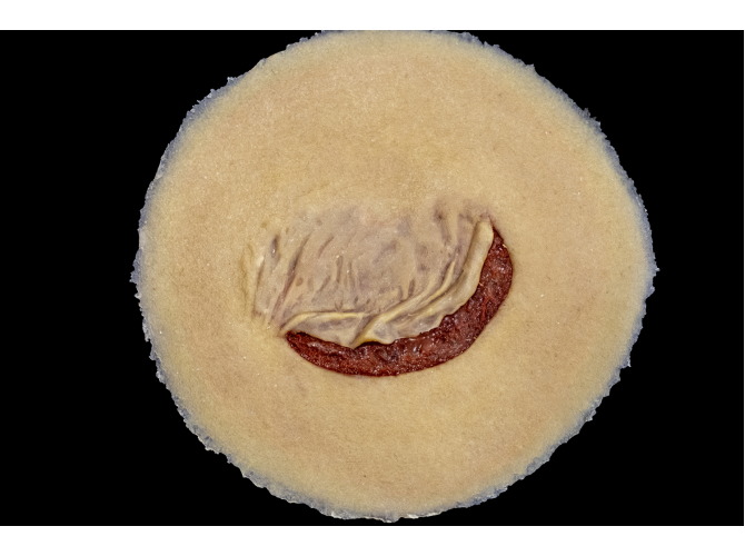 CS011Clinical_Sticky_SkinTear-FLAP_Medium2Web