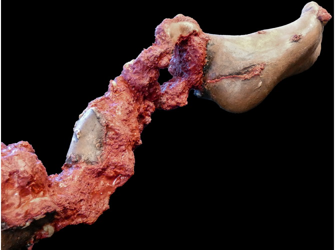 906_PT-Leg_Left_DarkSkinTone1