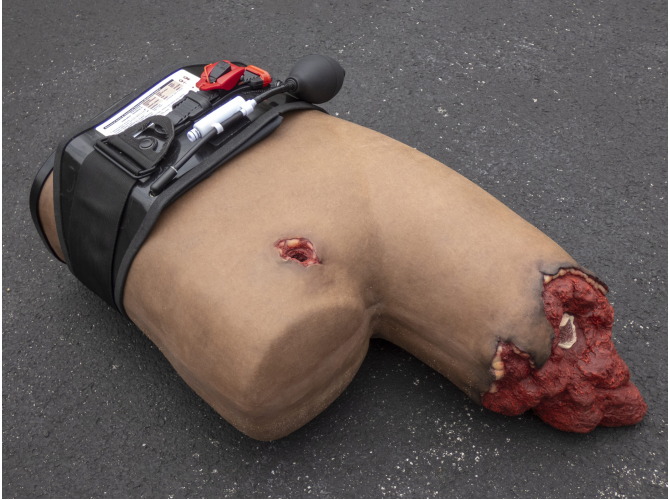 P1010800_B80_AAJT-S_Abdominal