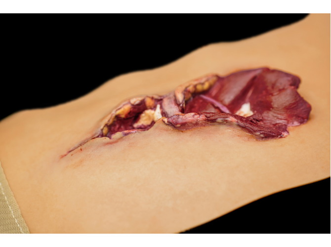 908_GSW_Biceps_MedSkin