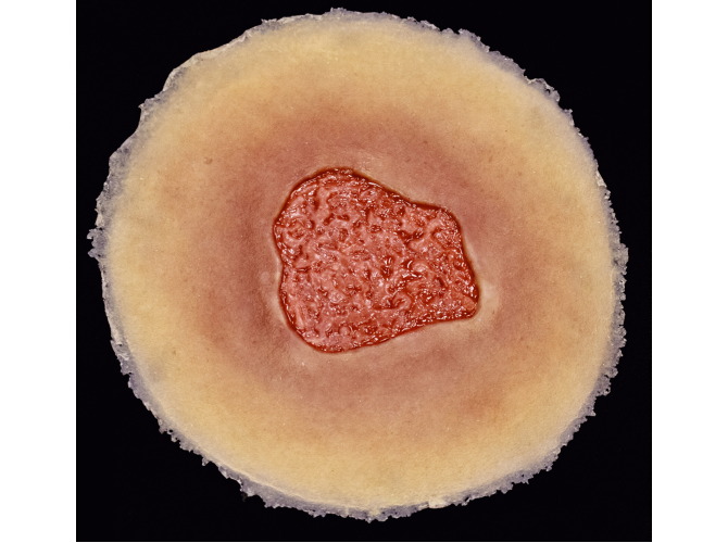 CS013-Granulation_SelfAdhesiveMED1