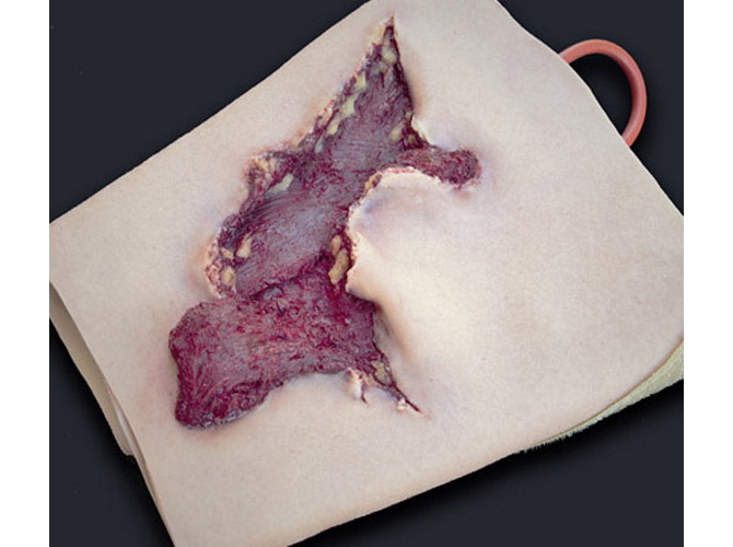 009_CalfAvulsion_Light