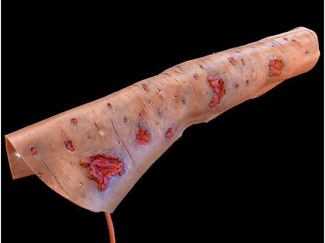 754Shrapnel_Left_DarkSkinTone