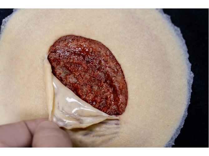 CS011Clinical_Sticky_SkinTear-FLAP_Light1Web