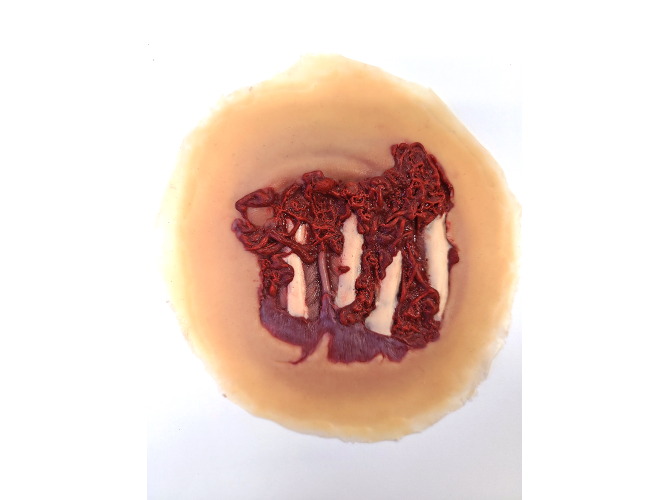 SW015_Sticky-deglovedHand_1