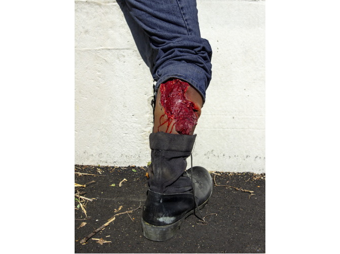 009_CalfAvulsion_DarkTone_a